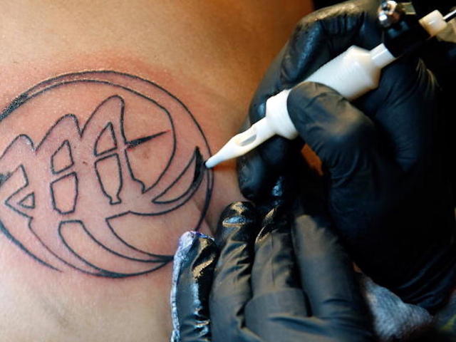 Tattoo to blame for Australian woman's incorrect cancer diagnosis