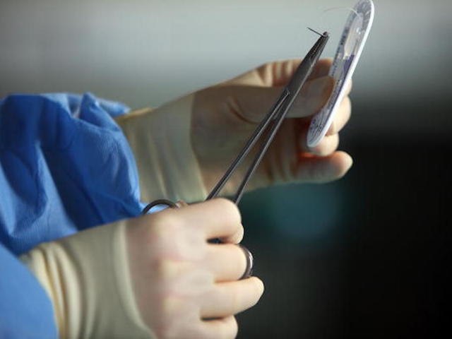 132-pound ovarian tumor removed from Connecticut woman