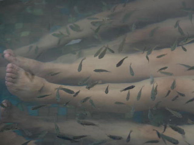 After fish pedicure, woman loses her toenails
