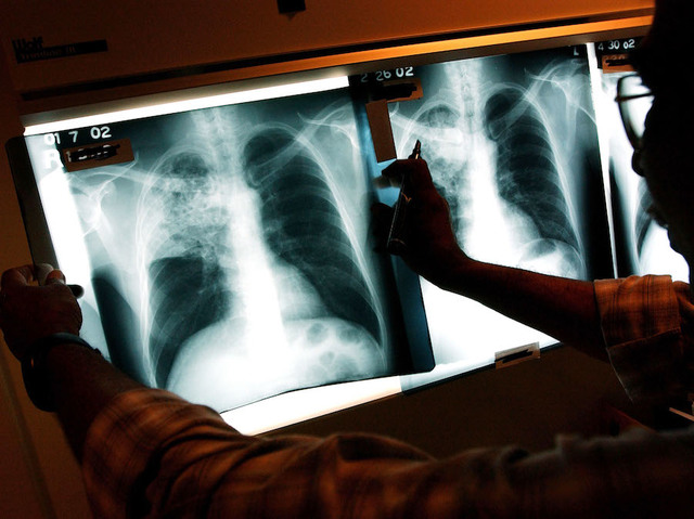 Possible release of tuberculosis bacteria investigated in Baltimore