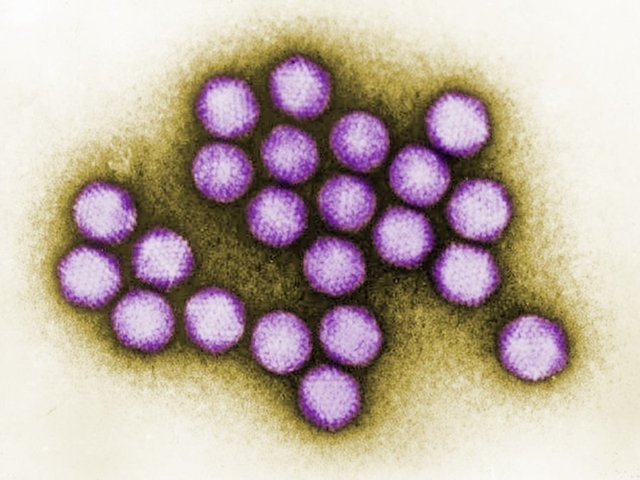 9th child dies after virus outbreak at New Jersey facility